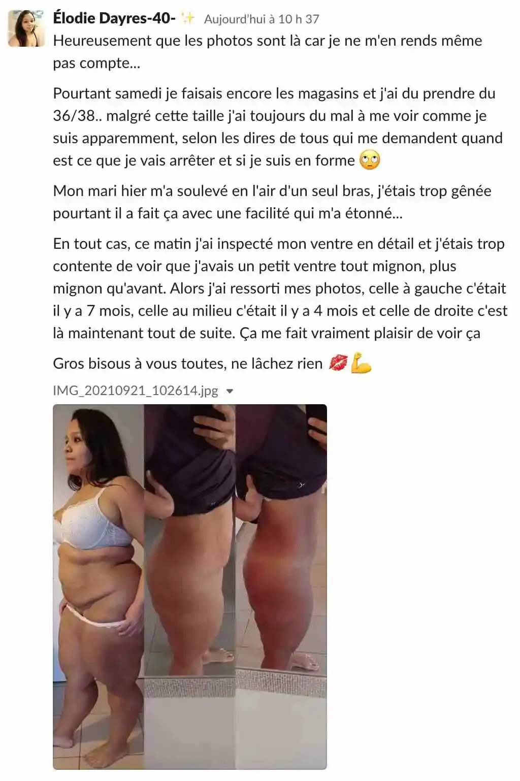 Le témoignage d'Élodie qui a en partie réussi à rattraper son relâchement cutané