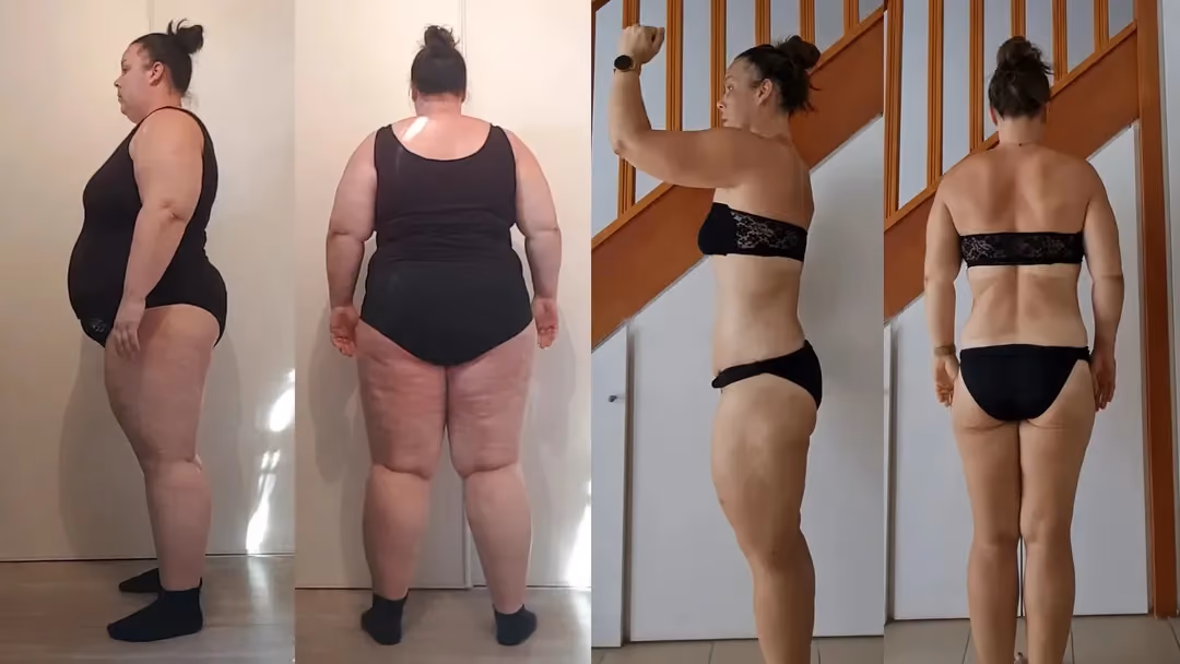 Extreme body transformation, 60-kilogram weight loss
