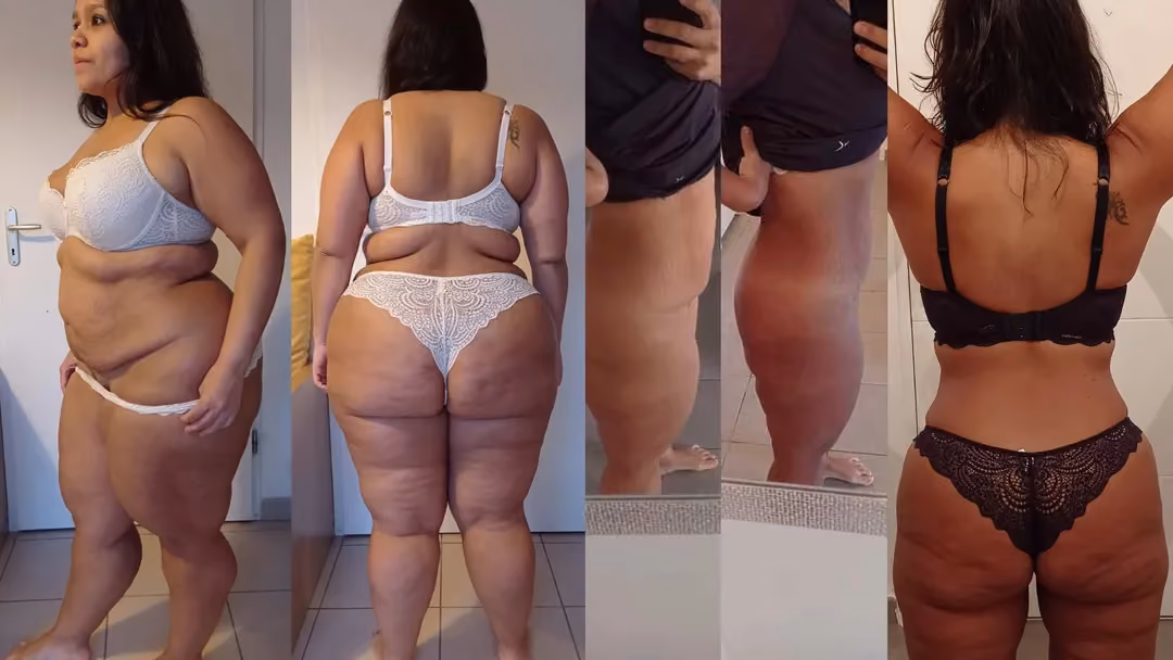 Elodie's extreme weight loss through fitness