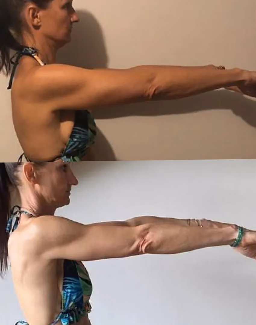 Bras fermes et dessinés d'une femme de 50 ans.