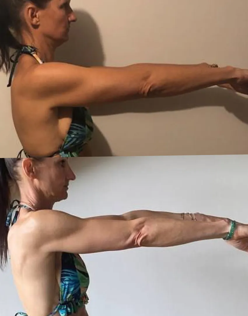 Bras fermes et dessinés d'une femme de 50 ans.