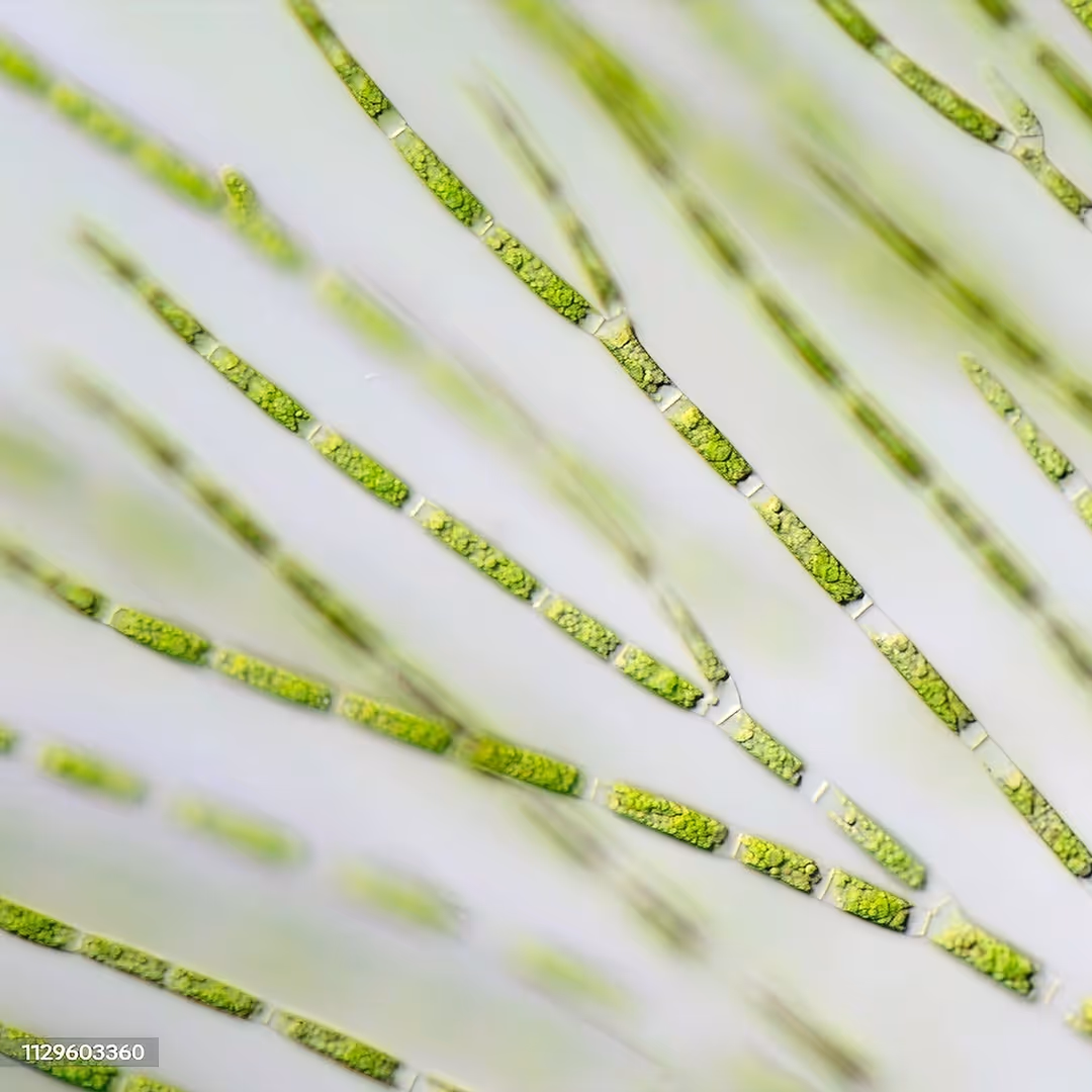 Close-up view of green filamentous algae cells under a microscope.