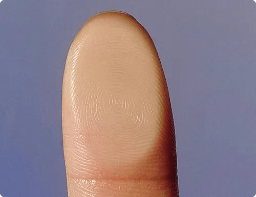 A finger that has a ring on it.