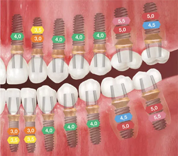 ts-dental