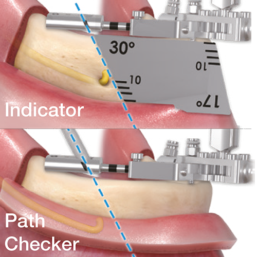 Step-4