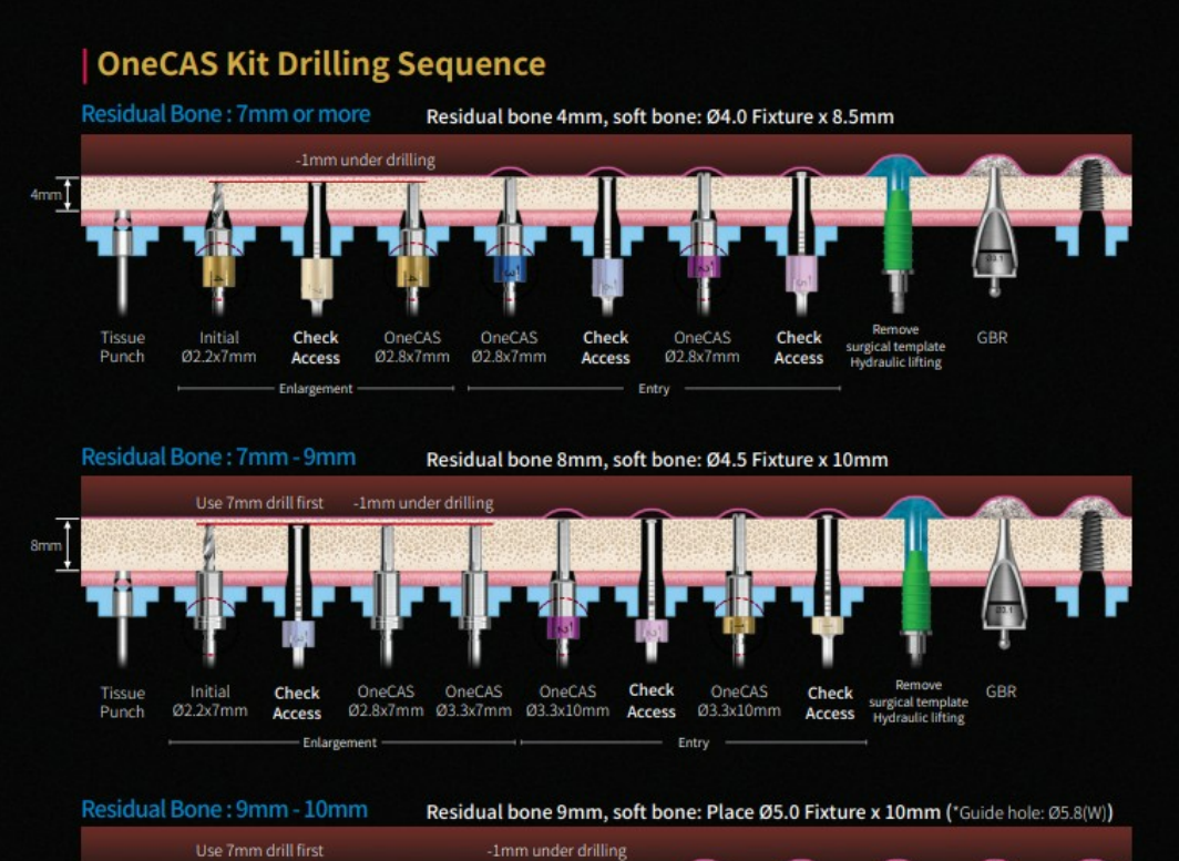 OneCas Kit DrillingSequence