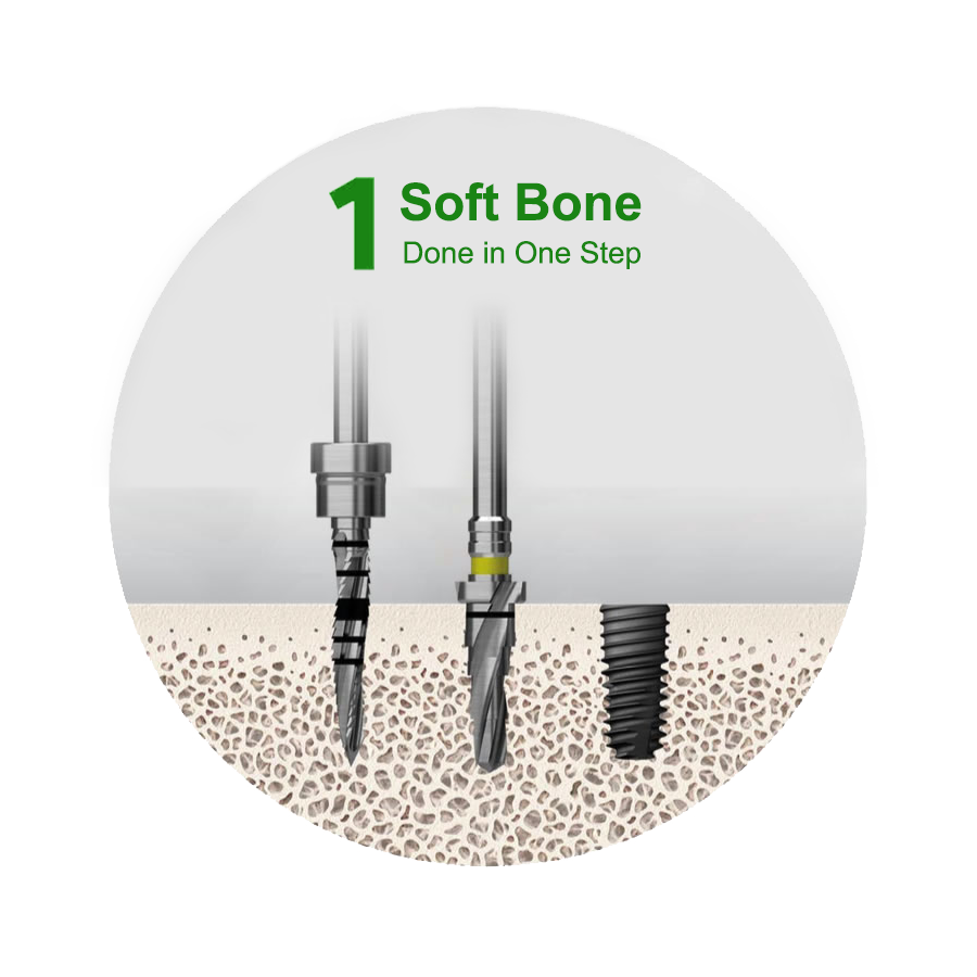 122 Taper  Kit