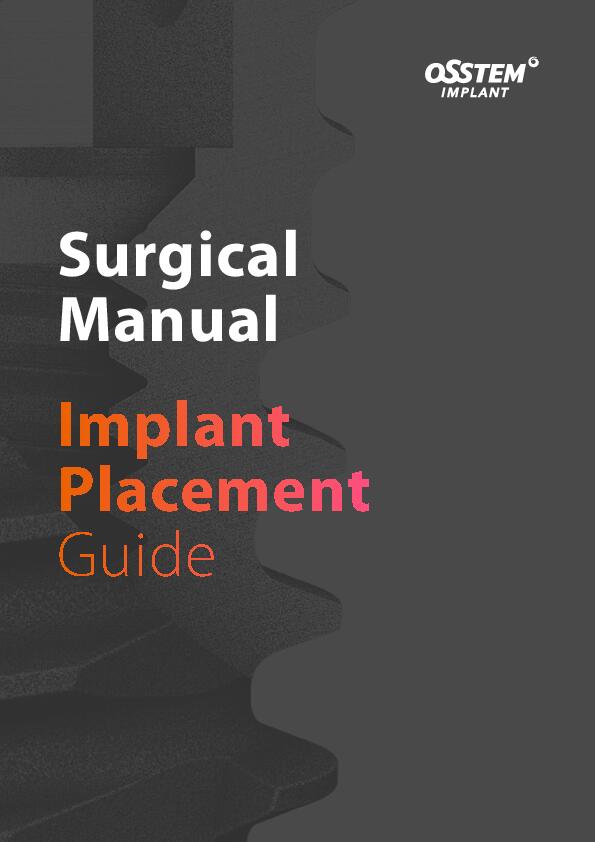 Surgical-Manual | Implant Placement Guide