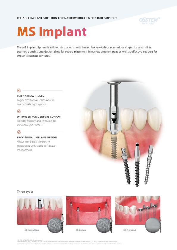  Flyer | MS Implant System