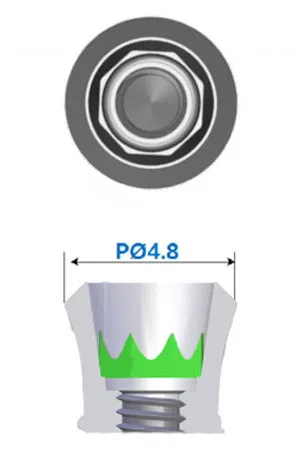 SS Implant