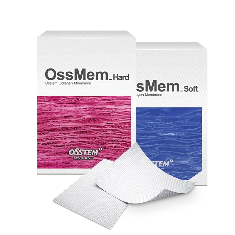 OssMem