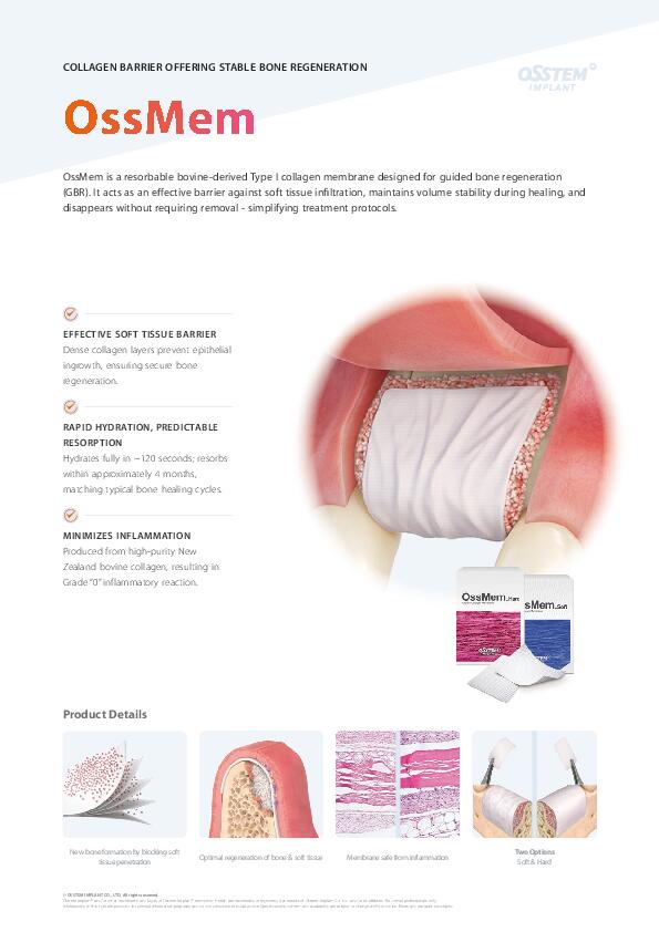 Flyer | OssMem