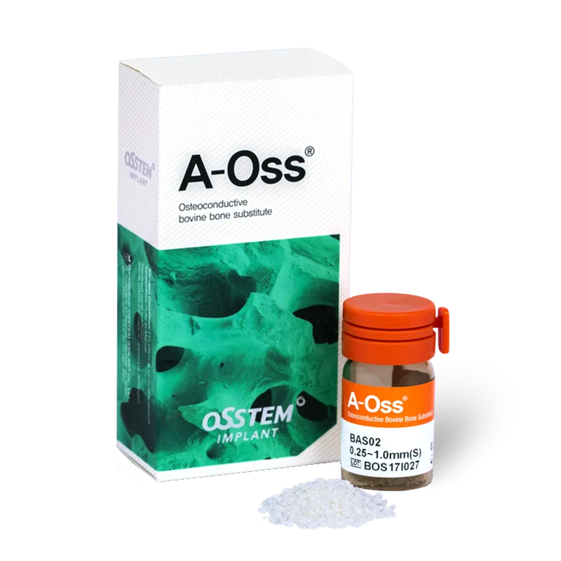 A-Oss
