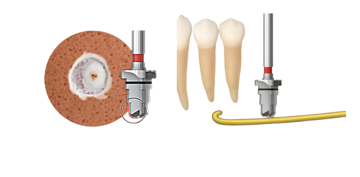 485 Kit
