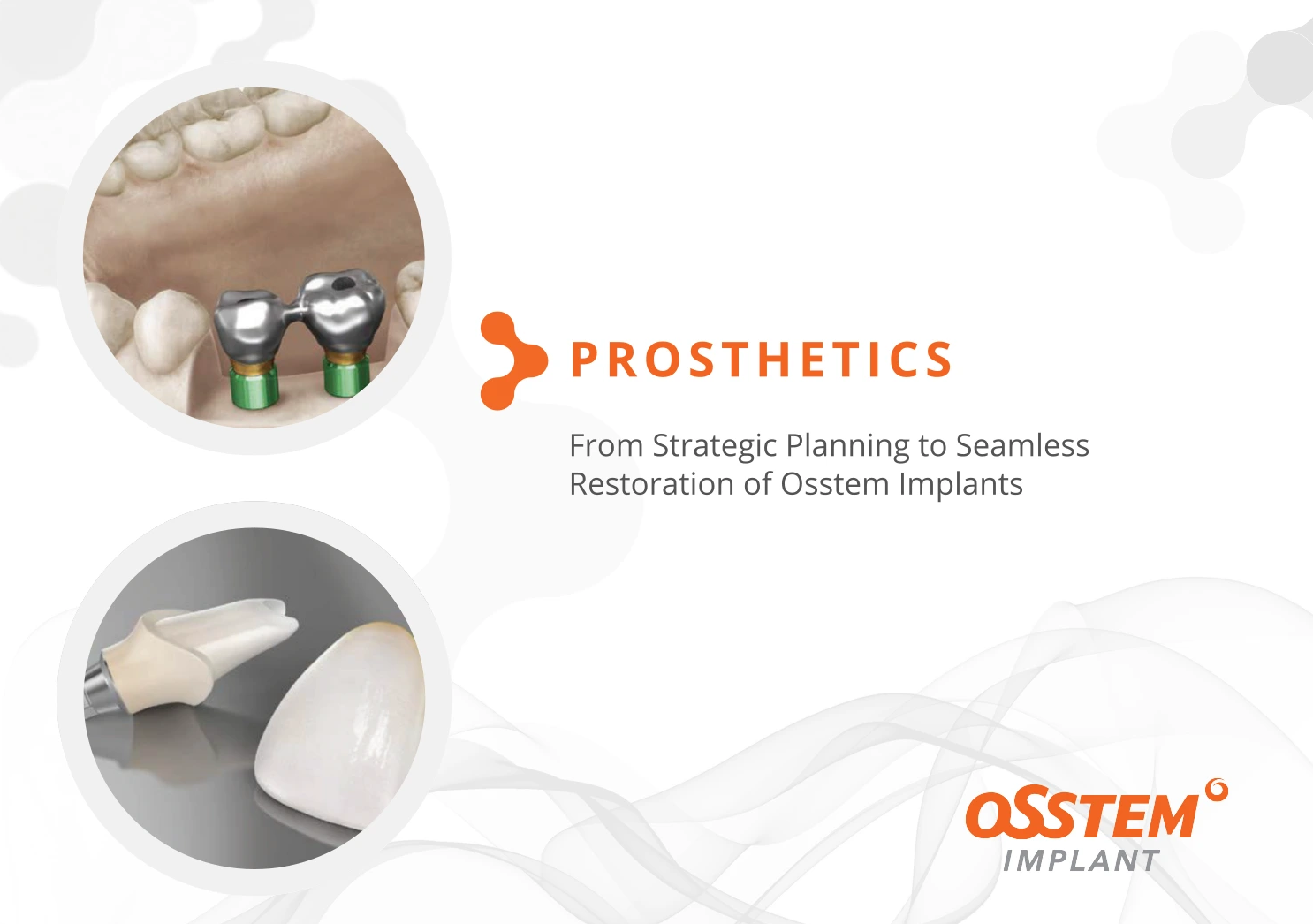 Prosthetics