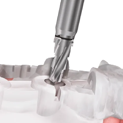 OneGuide Kit