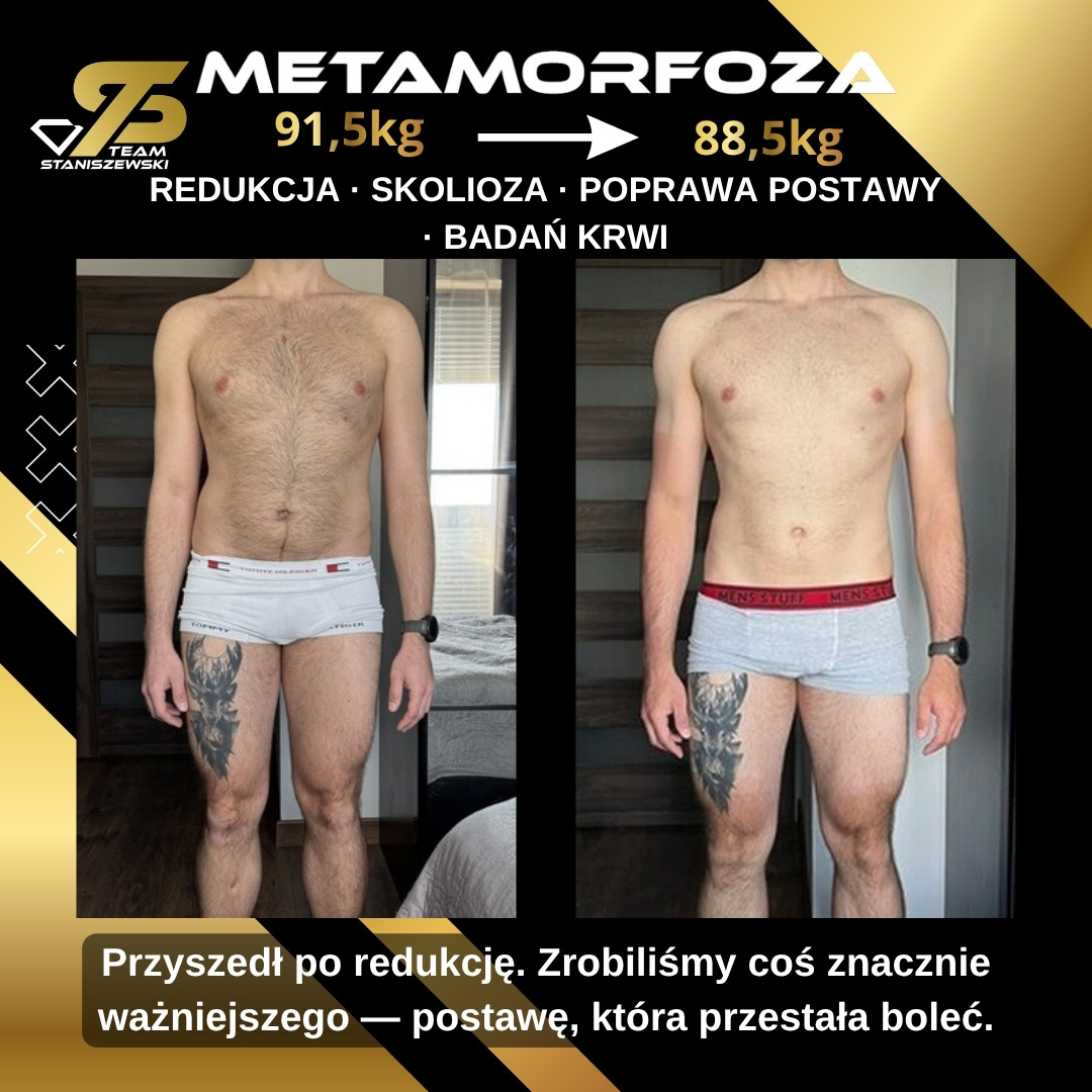Łukasz K. — 91,5 kg → 88,5 kg, ujecie z przodu