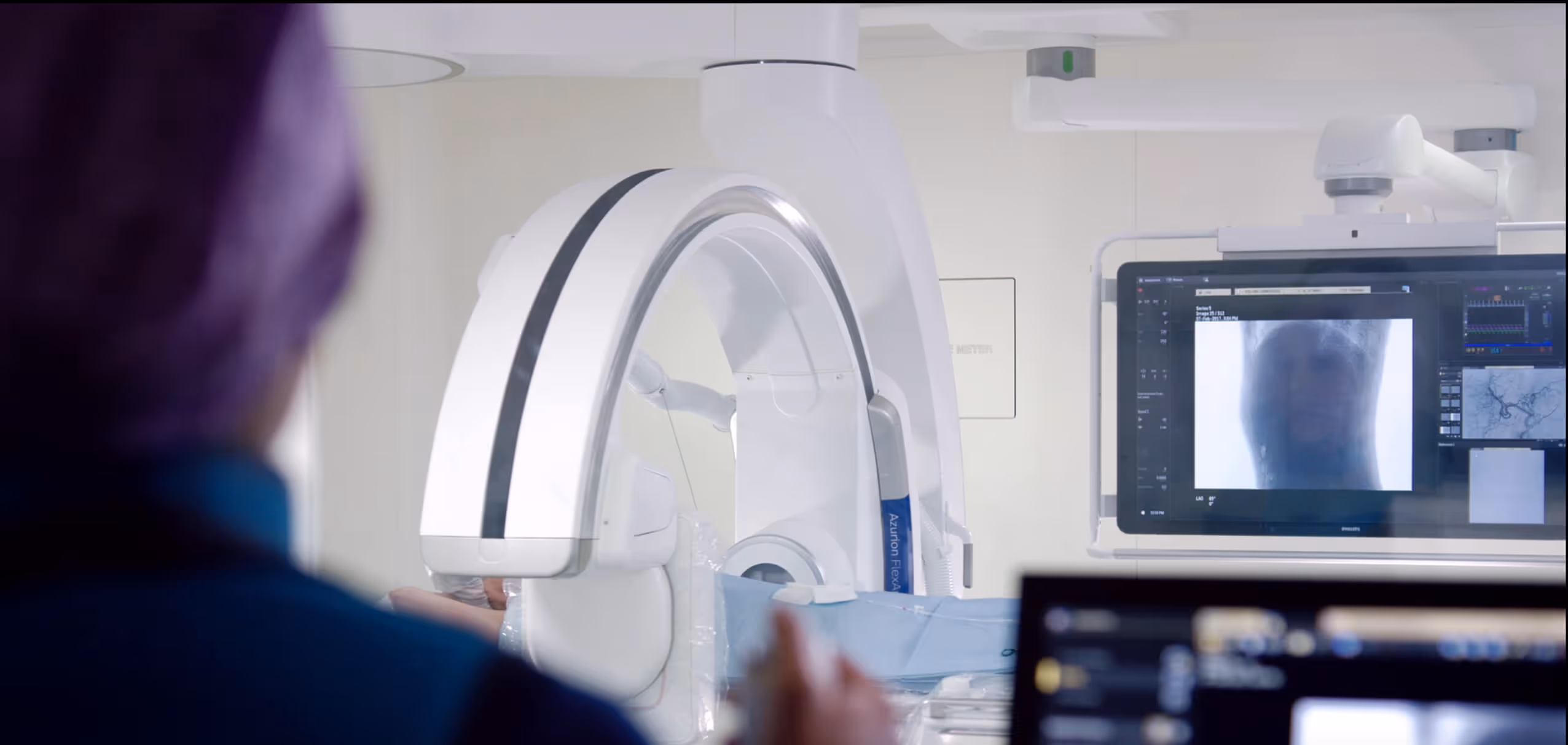 Medical professional operating near the angiography C-arm machine and viewing a scan.