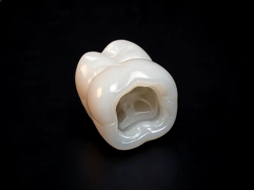 Properly designed fillings, crowns, and bridges restore the natural contours of teeth to re-establish balanced occlusion and prevent jaw pain.