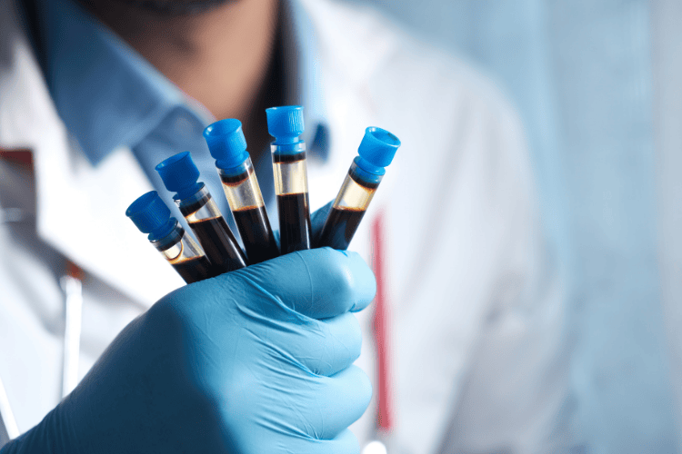 Testosterone therapy