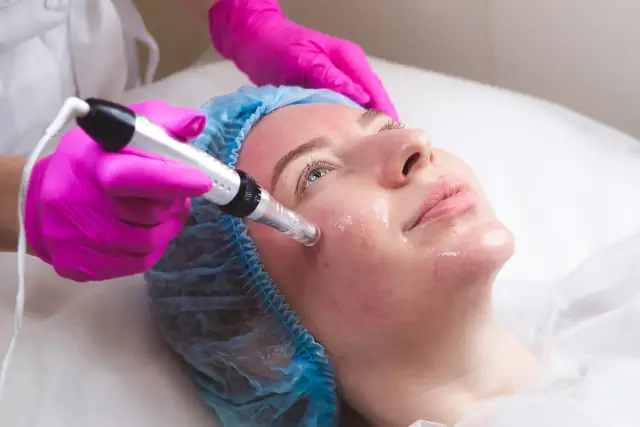 Mezoterapia mikroigłowa Dermapen