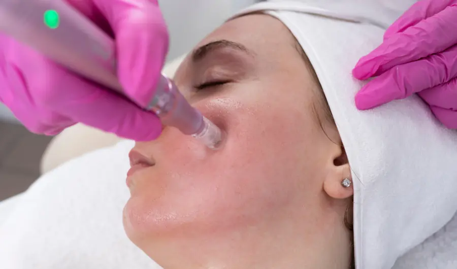 Dermapen co to zabieg