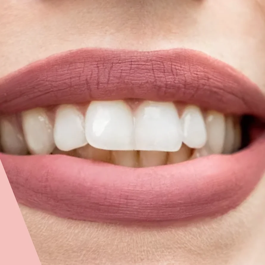 Close-up of a smile showing white teeth and lips with matte pink lipstick.