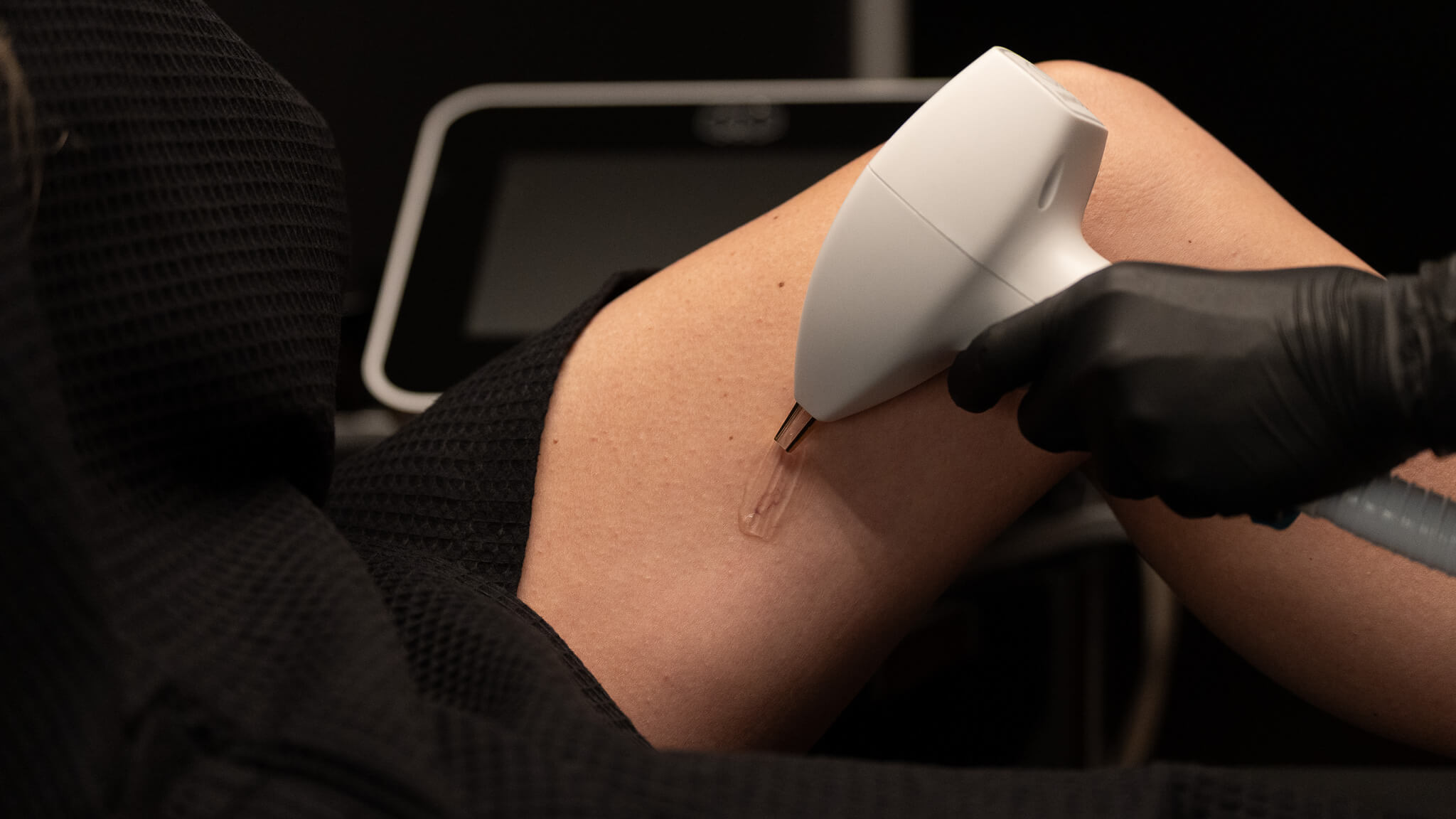 Vascular Lesion Removal