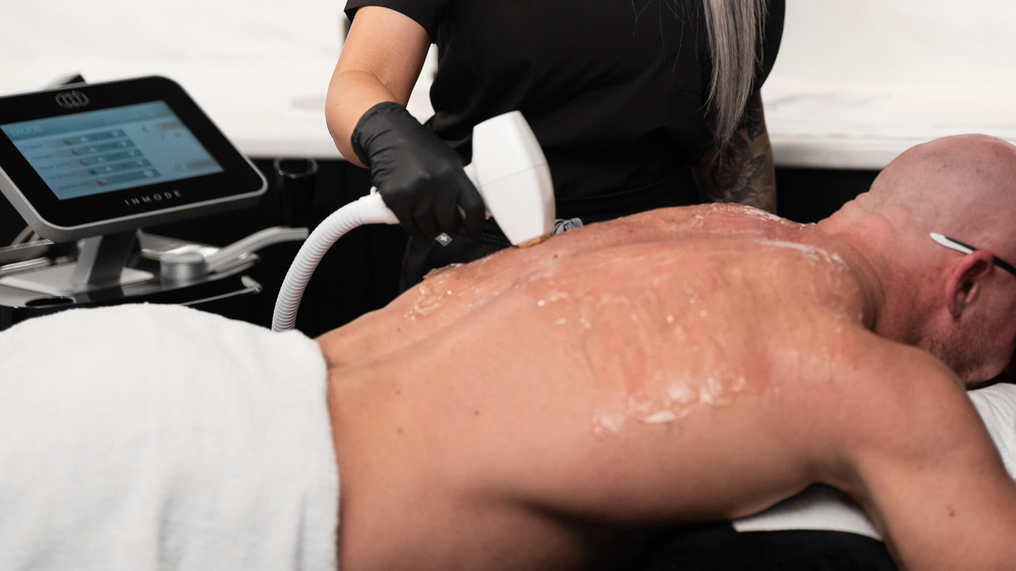 5 Myths About Laser Hair Removal Debunked