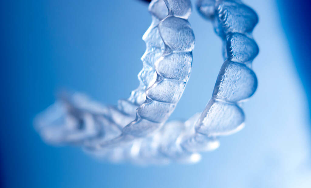 close up of clear aligners in little italy