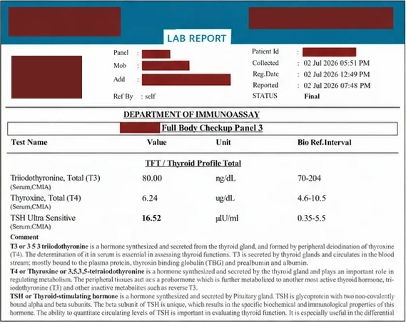 Thyroid report dated 2 July 2026, personal details and laboratory name redacted: T3 80.00 ng/dL, T4 6.24 ug/dL, TSH 16.52 µIU/mL (reference 0.35 to 5.5), with the laboratory’s explanatory comment.