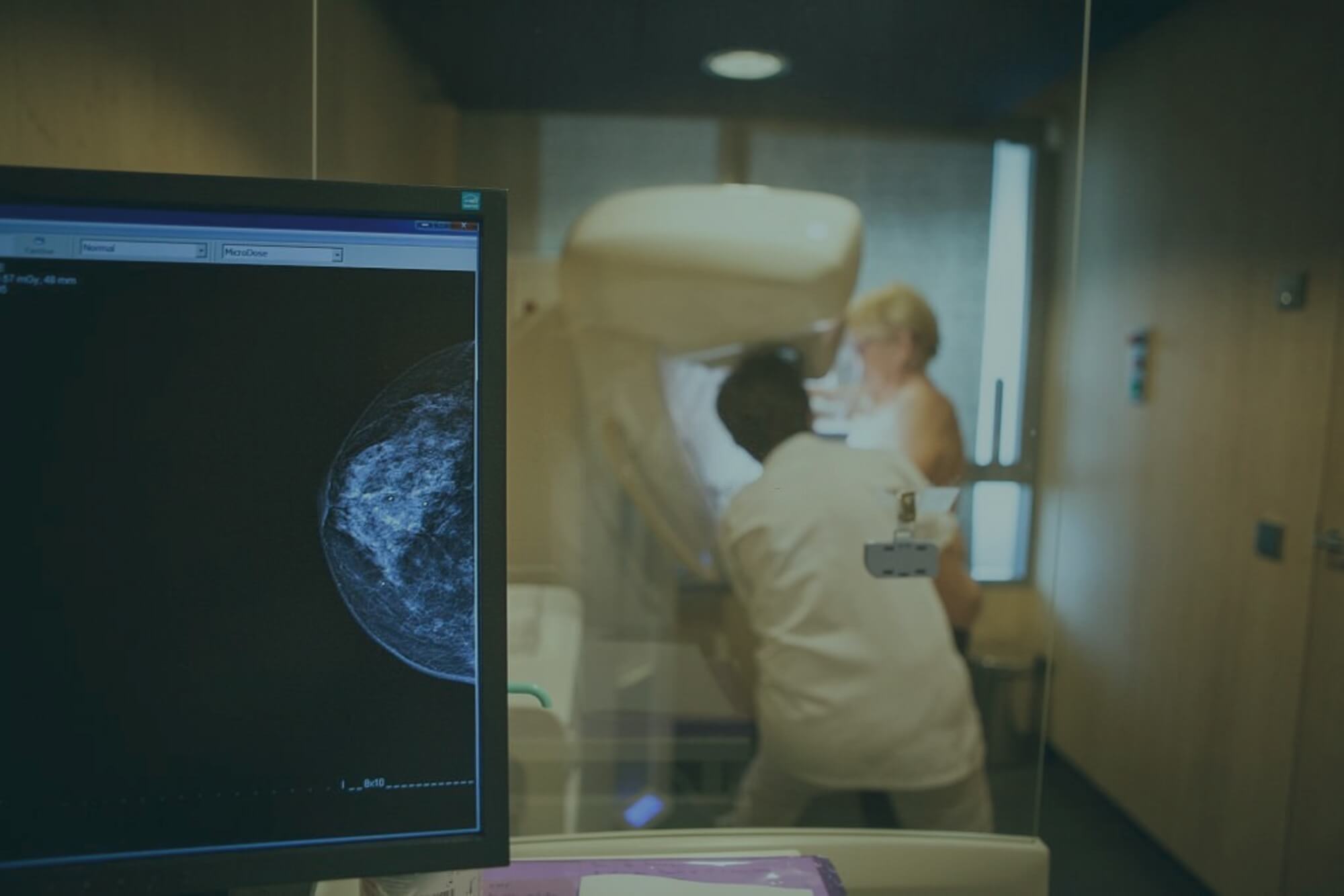 Verpleegkundige voert een mammografie uit met een modern mammografietoestel.