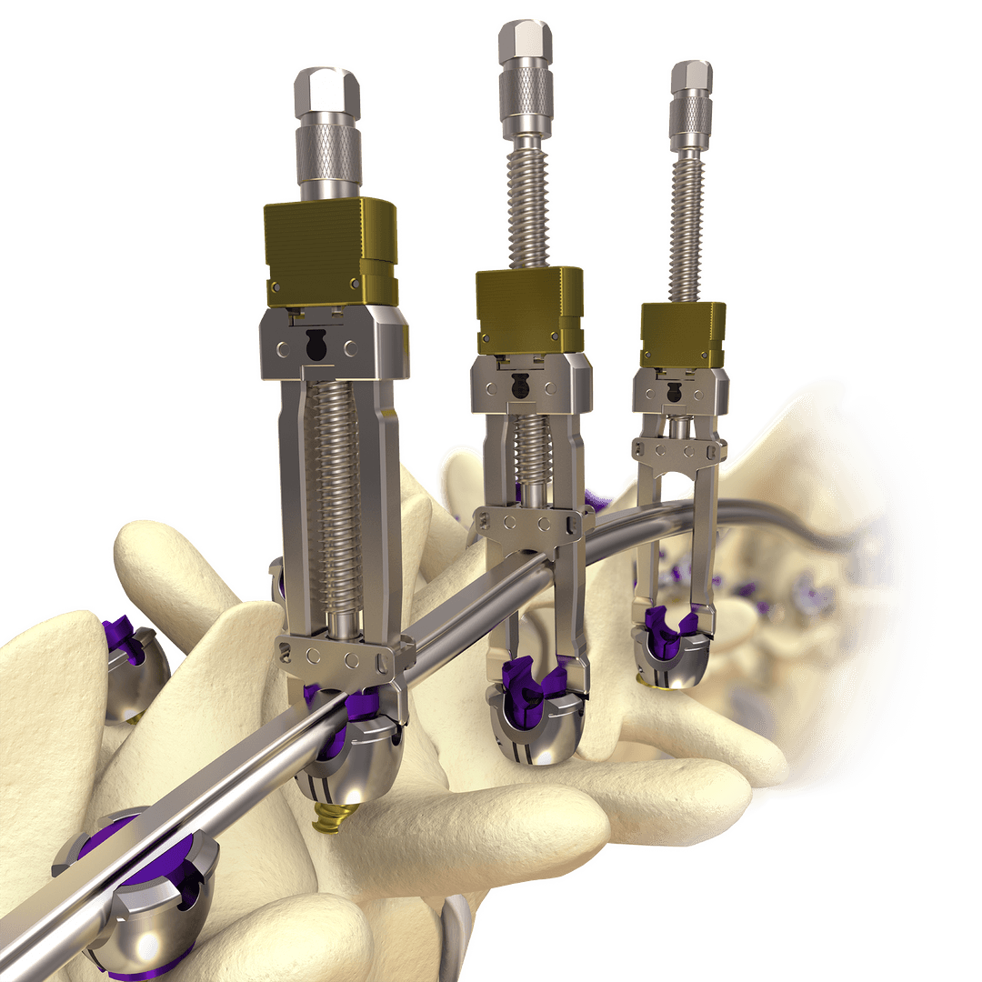 Large-format product shot render of a spine system, booth-ready
