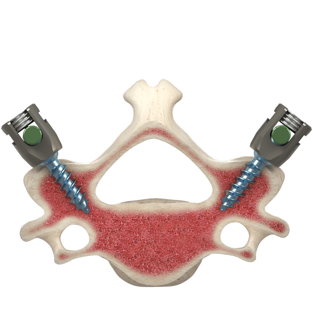 Cervical spine cross-section brochure render