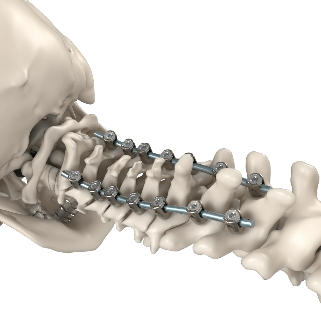 Cervical construct