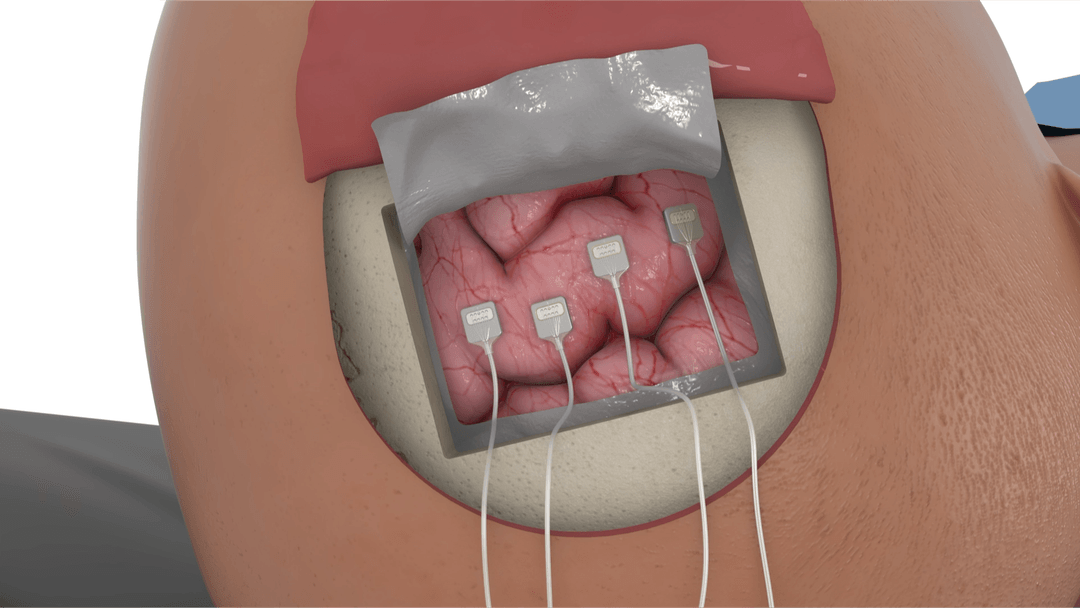Neural device render used as a single frame in an investor deck