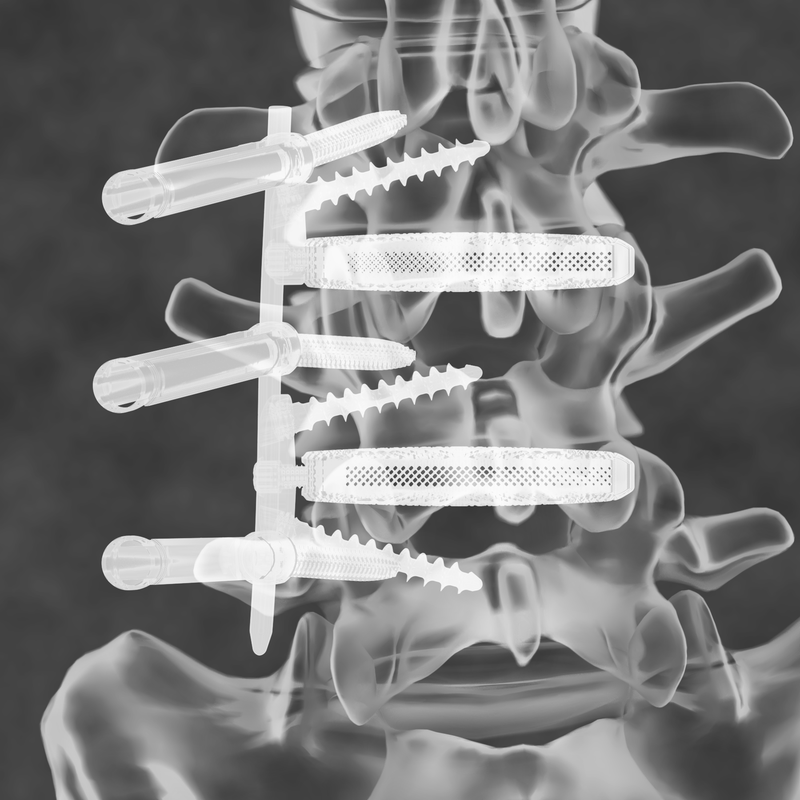 Fluoroscopic-style spine render
