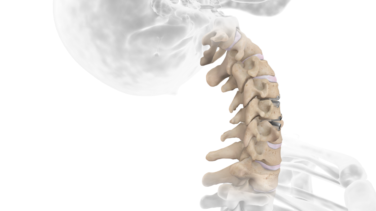 3D illustration of the cervical spine vertebrae highlighted in beige within a transparent upper body and skull.