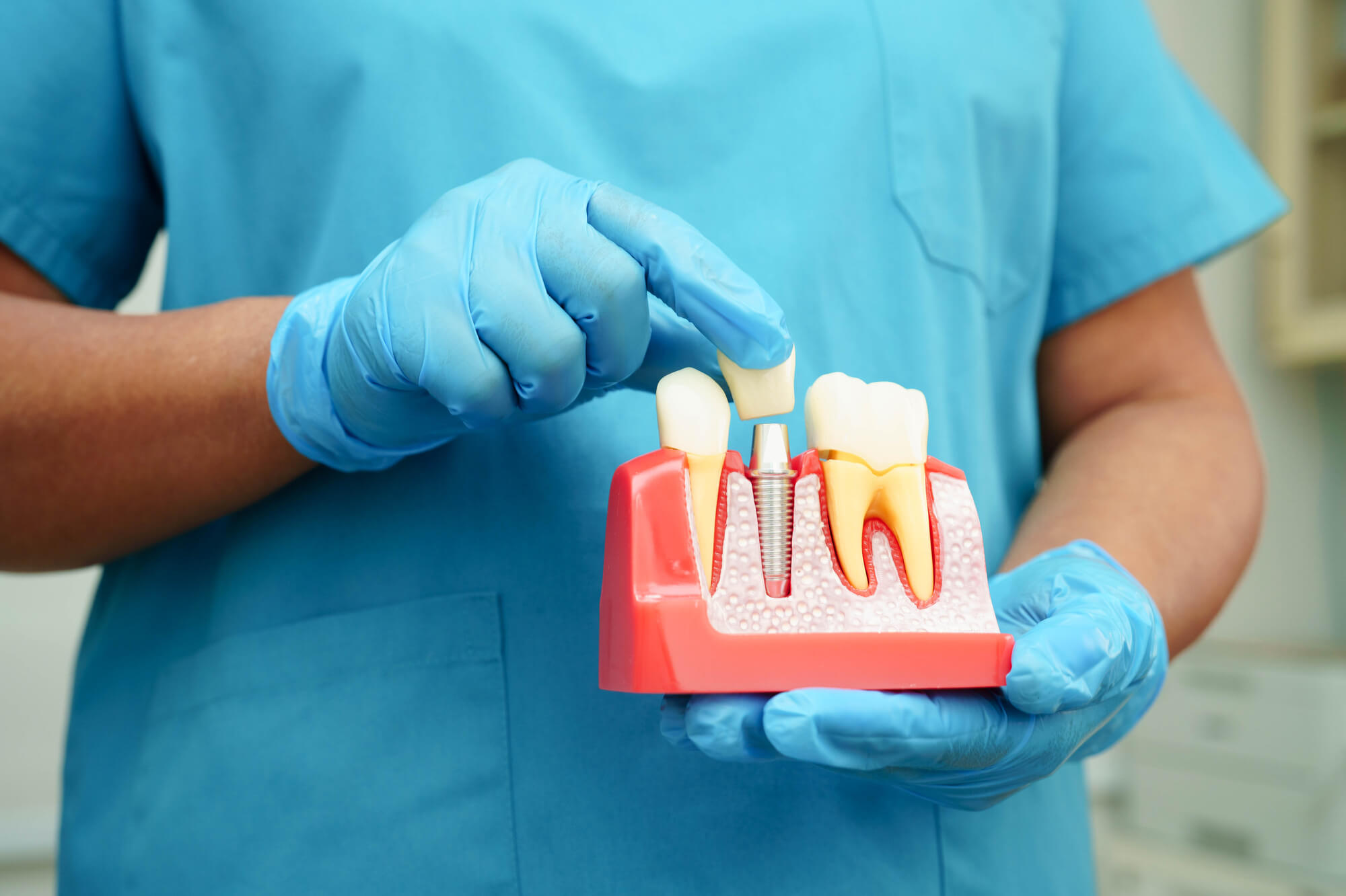 A dental professional in blue scrubs and gloves holds a model of teeth, demonstrating dental anatomy and procedures.