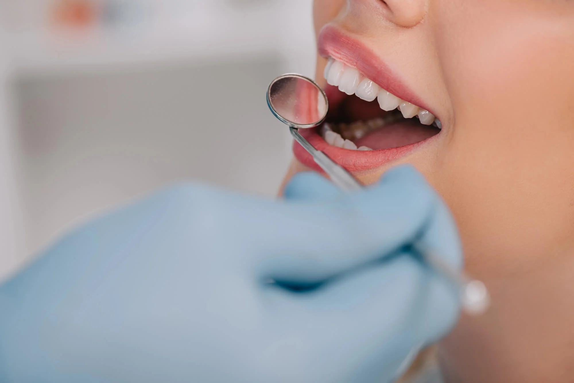 Closeup of dental mirror examining teeth – best dentist in Madison, AL
