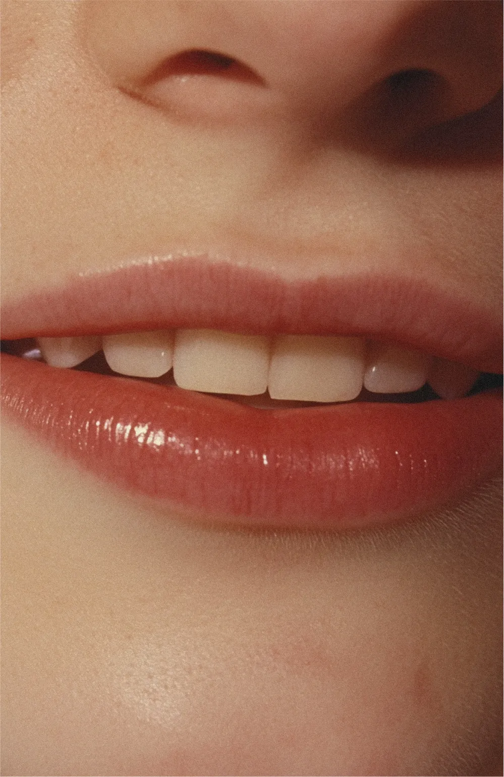 Close-up of a smiling mouth showing lips and upper front teeth.