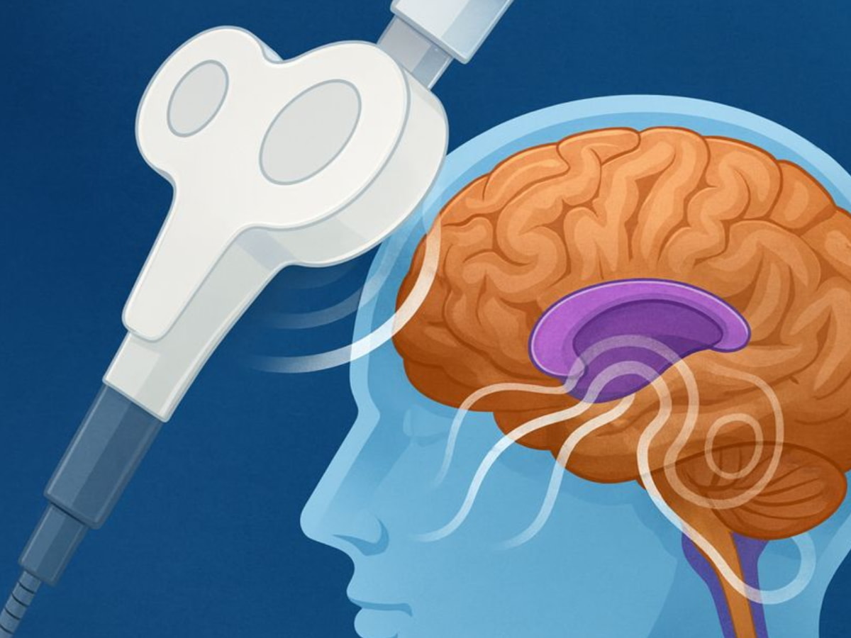 A person using a brain stimulation device, focusing on enhancing cognitive function through electrical impulses.  