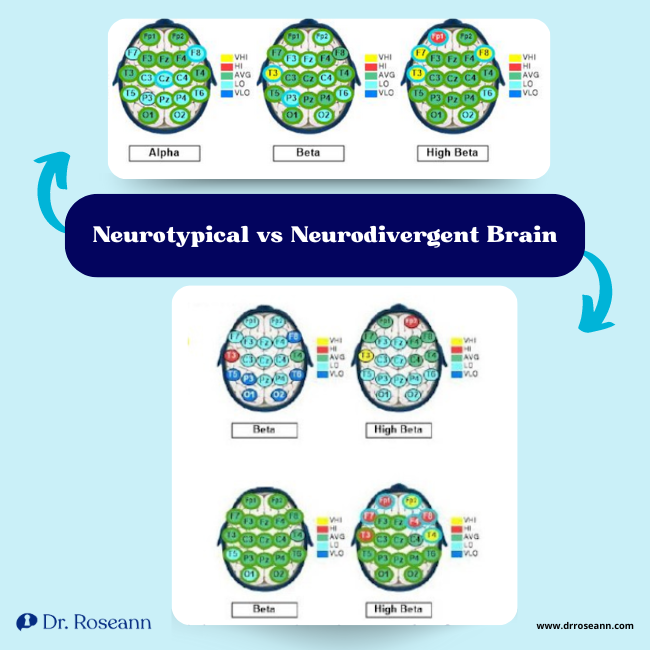 Brain wave pattern diagrams showing neurodivergent umbrella variations in alpha, beta, and high beta states