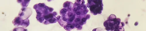 Close-up microscopic view of clustered purple stained cells on a light background.