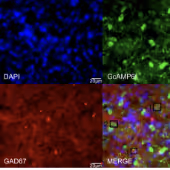 Four microscopy images of neurons from bat midbrain tissue using four different florescent staining techniques