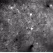 Microscopy image of neurons in from amnestic mouse brain tissue