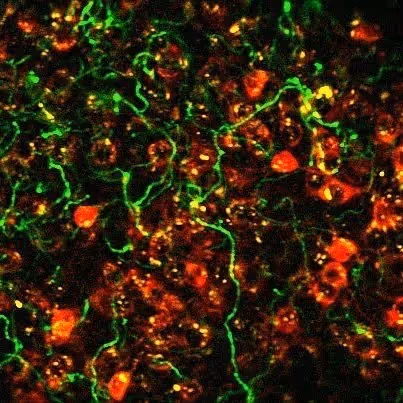 Microscopy image of fluorescent staining in cholinergic basal forebrain 