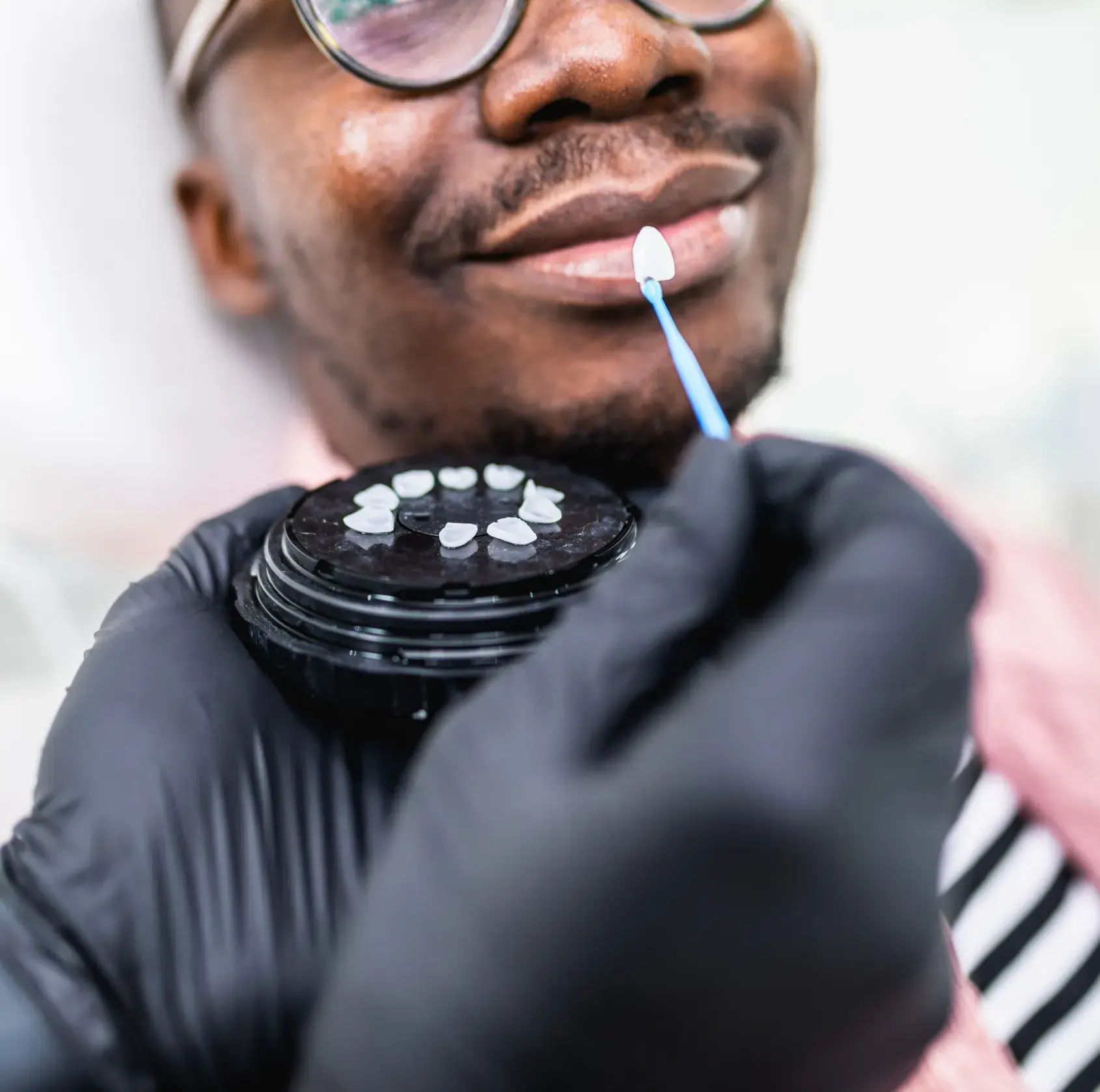 A dentist adjusts a dental veneer on a patient's tooth using a tool.