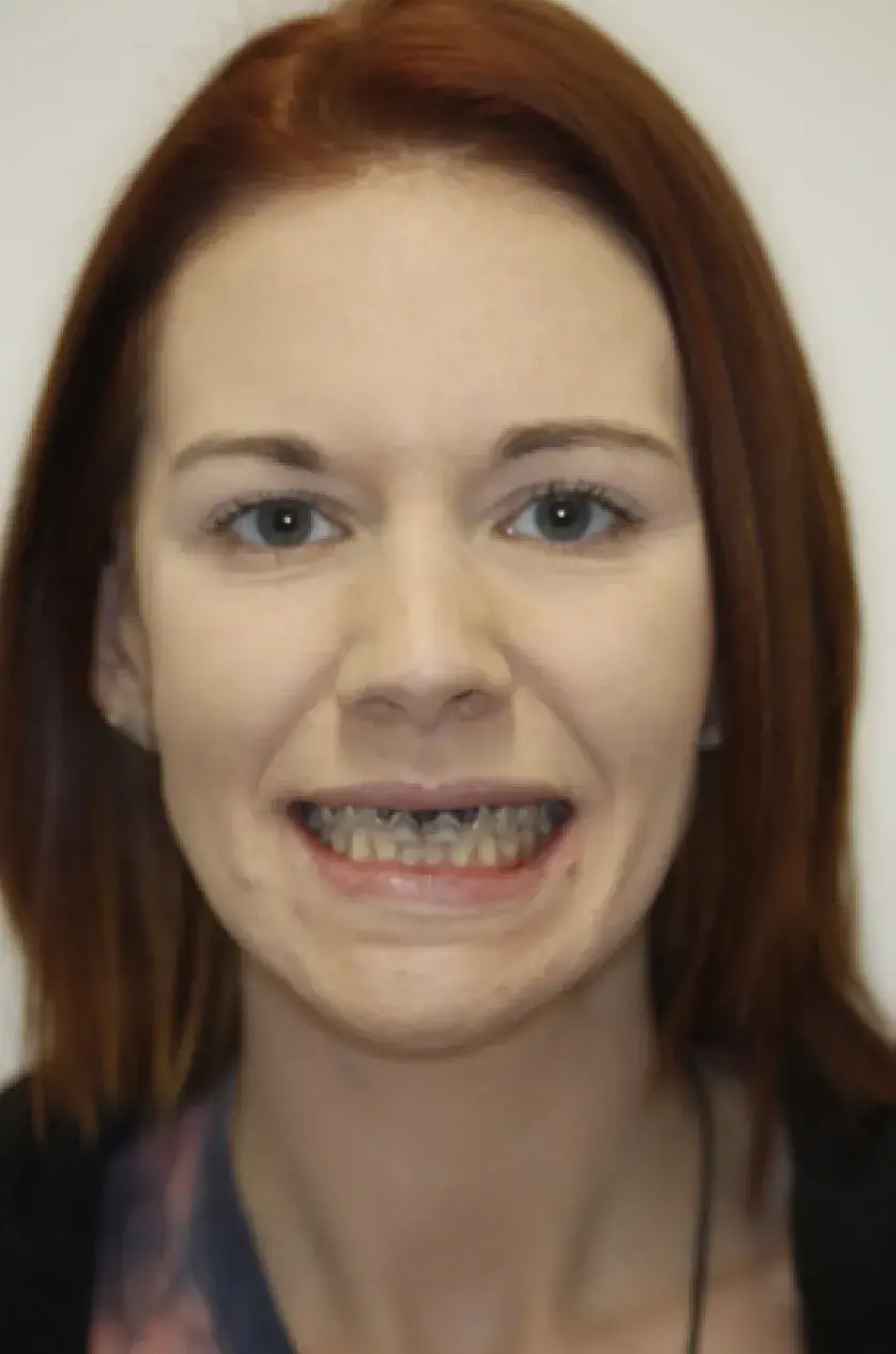 A woman with red hair and braces on her teeth smiles at the camera.