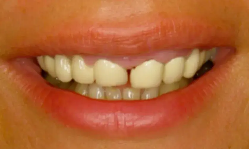 A close-up of a person's smiling mouth showing teeth and lips.